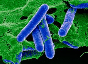 Clostridium botulinum, or Botox in the wild.  (Photo Credit: Dr. Gary Gaugler/Science Photo Library)